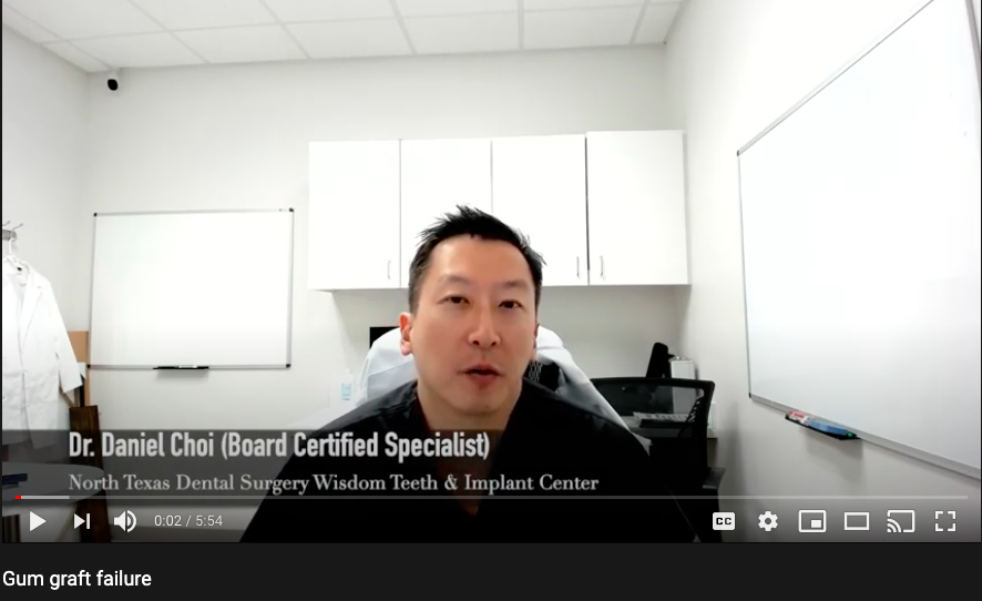 Gum Graft Recovery Instructions North Texas Dental Surgery